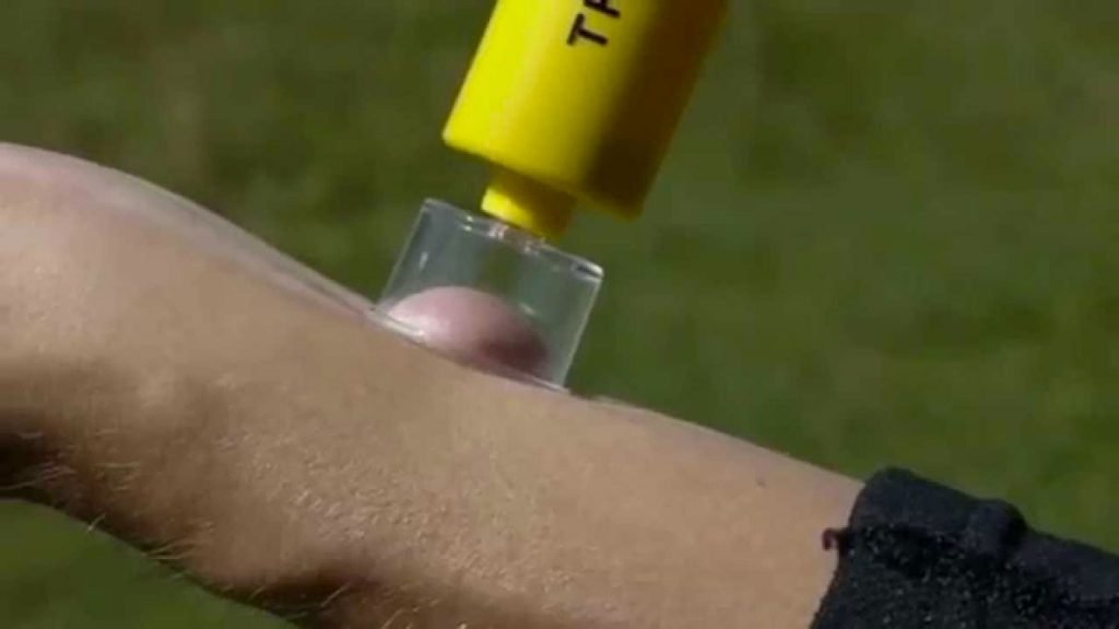 pompa estrattore regalol