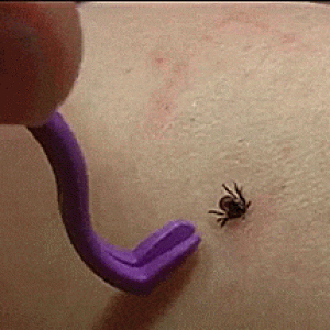 Rimuovi Zecche Rotante